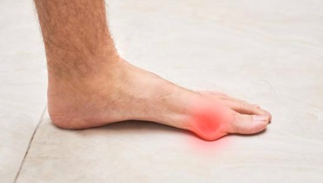 Most Painful Foot Conditions