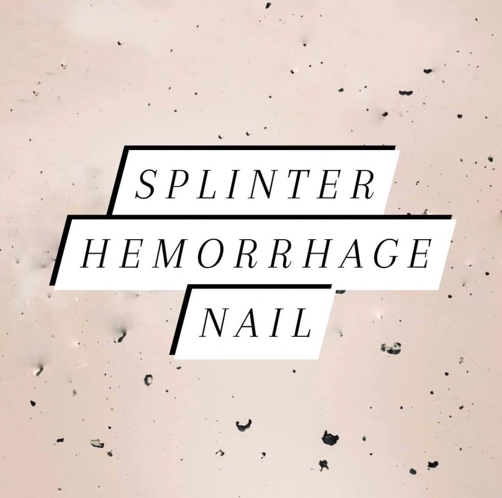Splinter Hemorrhage Nail